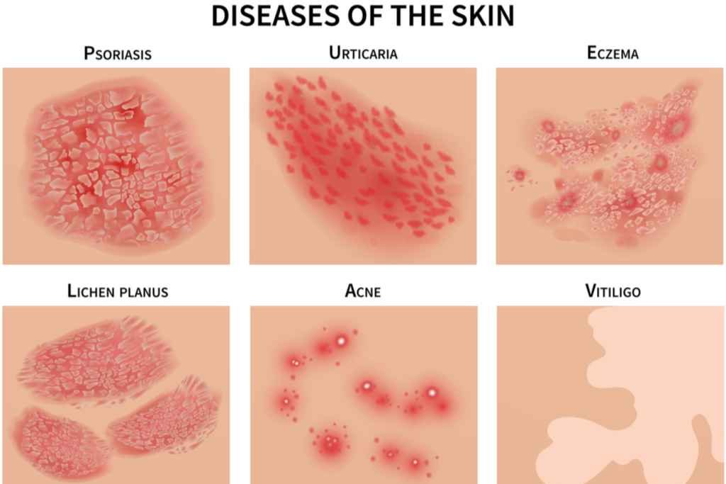 Treatment Of Skin inflammation