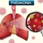 What is mysterious pneumonia?