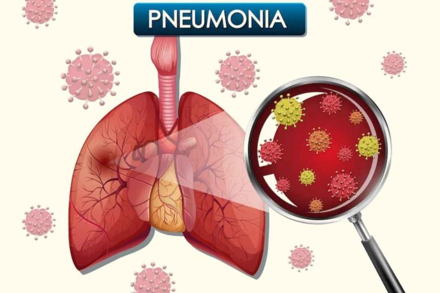 What is mysterious pneumonia?