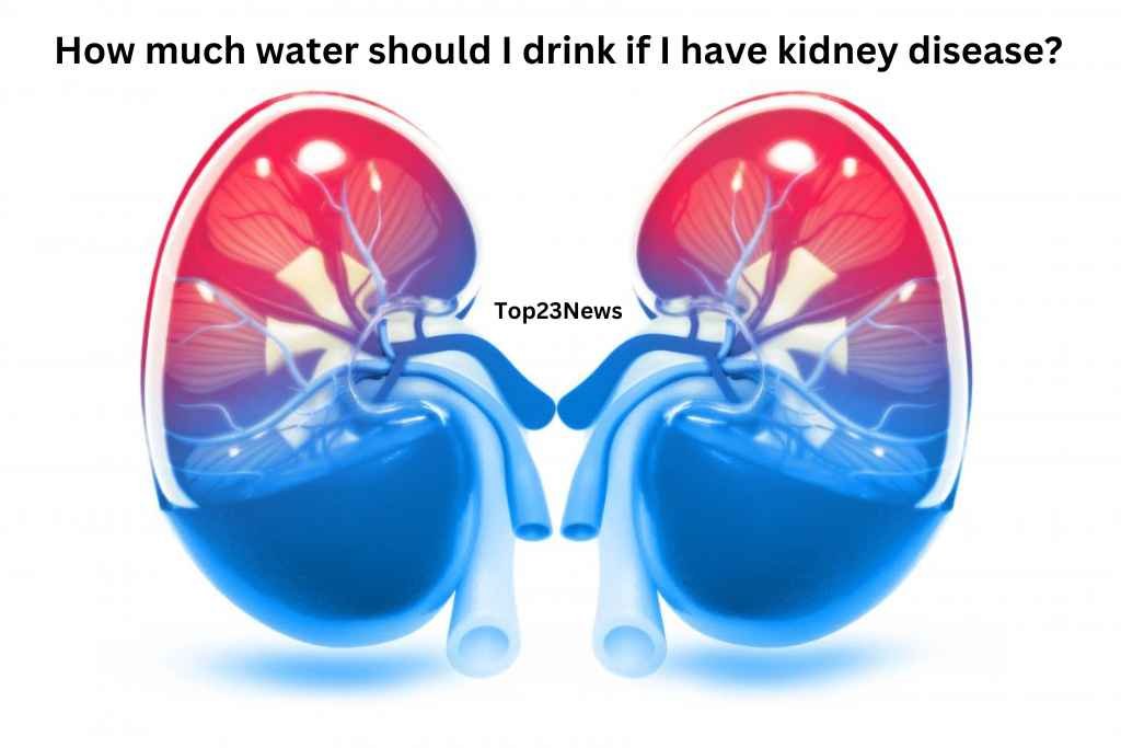  kidney disease?